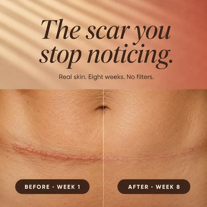 Silicone Collagen Scar Tape