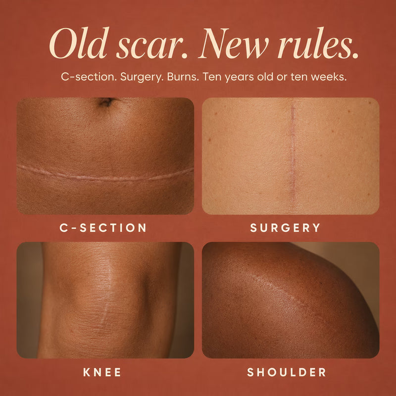 Silicone Collagen Scar Tape