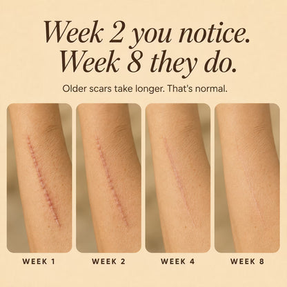 Silicone Collagen Scar Tape