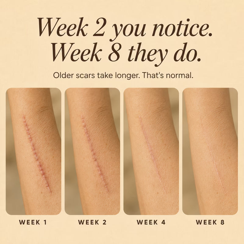 Silicone Collagen Scar Tape