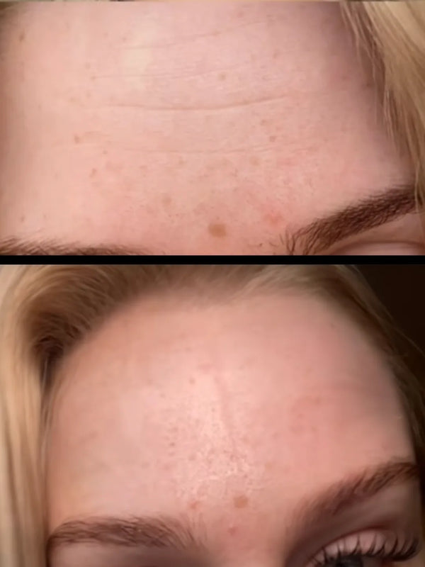 Before and after photo