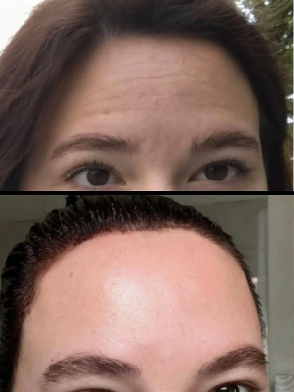 Before and after photo