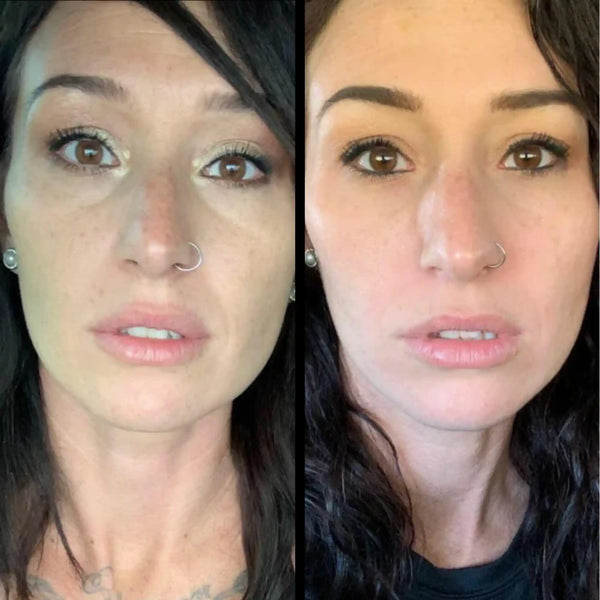 Before and after photo