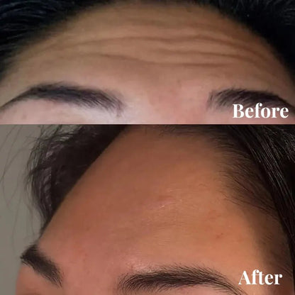 Amuee Silicone Scar Tape