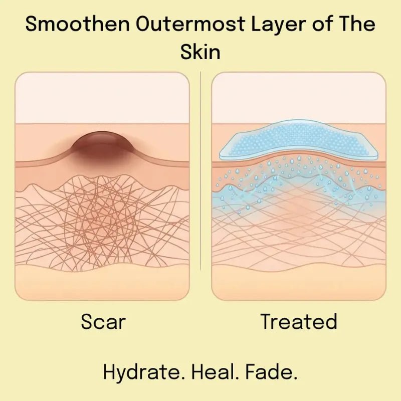 Amuee Silicone Scar Tape